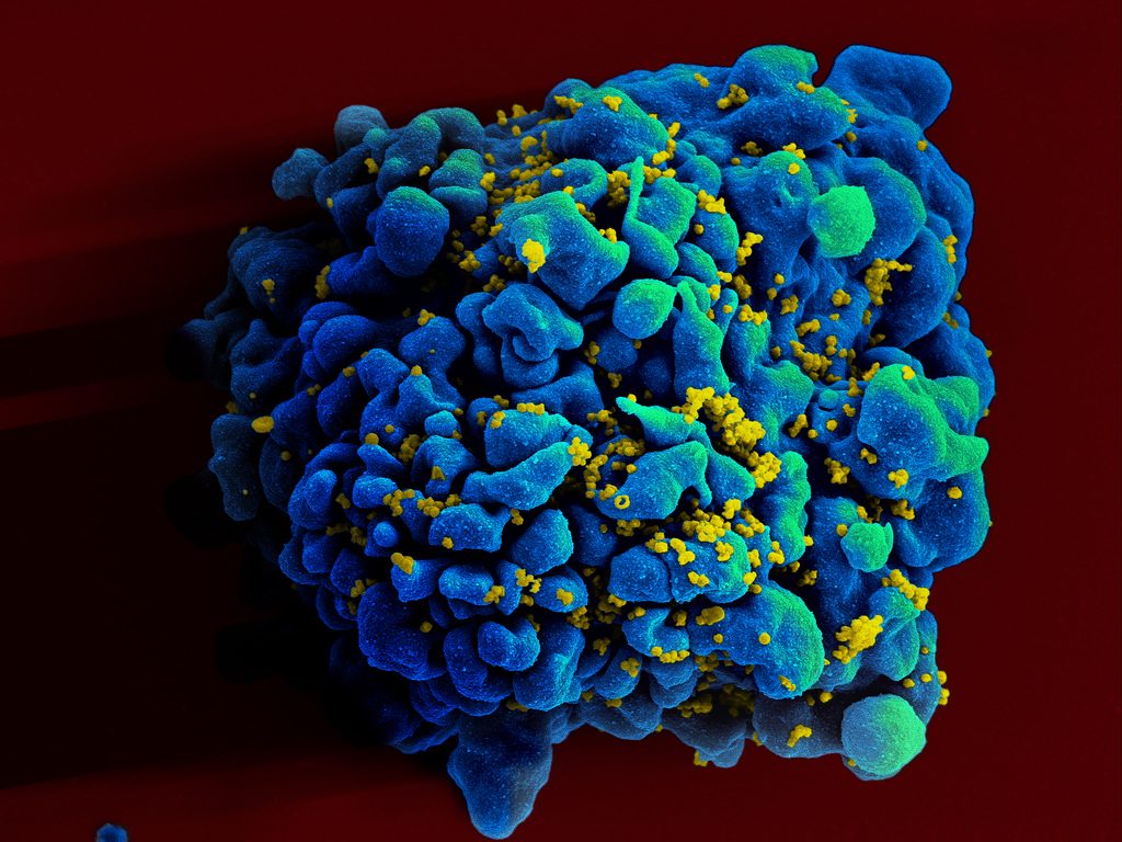 scientists have discovered how get immune t cells locate destroy mutated hiv