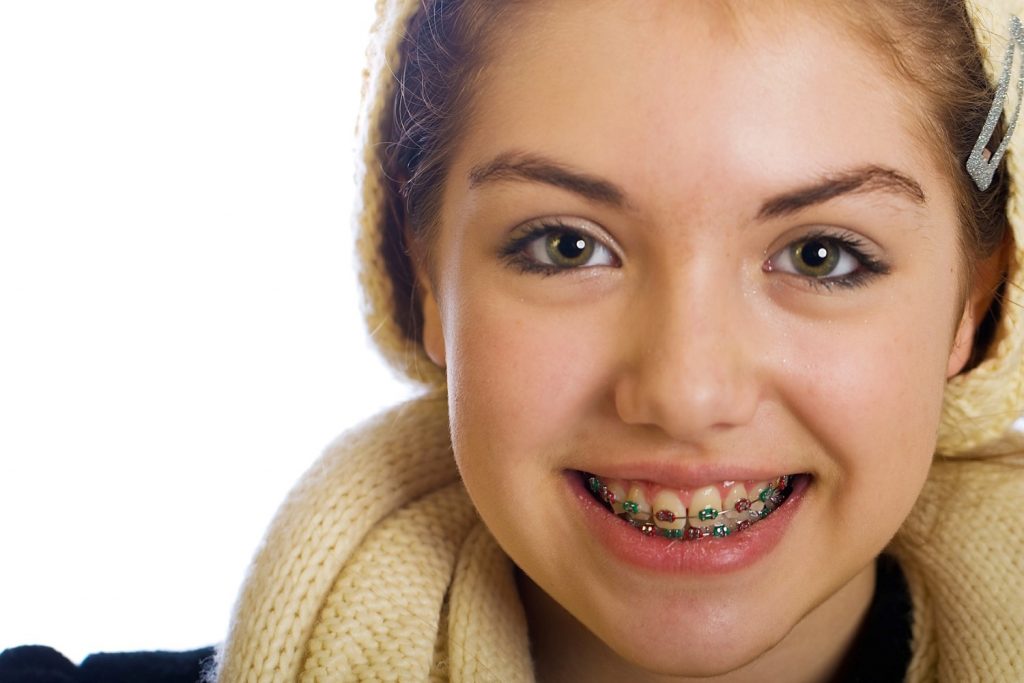 getting braces select an orthodontist that is well qualified Custom
