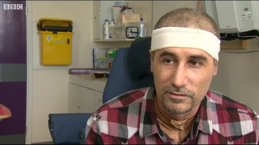 VIDEO Doi supravieţuitori ai iadului de la Colectiv vorbesc, de pe patul de spital din Anglia, despre tragedie: „Învăţăm iar cum să mâncăm şi cum să ne spălăm“ 1 colectiv